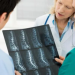 ¿Un tumor óseo siempre significa cáncer? Esto es lo que hay que saber 